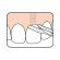 TePe Bridge and Implant Floss Οδοντικό Νήμα για Γέφυρες και Εμφυτεύματα 30 τμχ