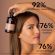Apivita Dry Dandruff Σαμπουάν Κατά της Ξηροδερμίας με Σέλερι και Πρόπολη 250 ml