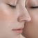 A-Derma Epitheliale A.H Ultra Καταπραϋντική Κρέμα κατά των Σημαδιών Spf50+ 100 ml