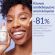 Caudalie Vinoperfect Brightening Dark Spot Serum Ορός Προσώπου κατά των Κηλίδων 30 ml