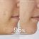 Caudalie Set με Vinopure Blemish Control Salicylic Serum 30 ml & Δώρο Vinopure Purifying Gel Cleanser 150 ml