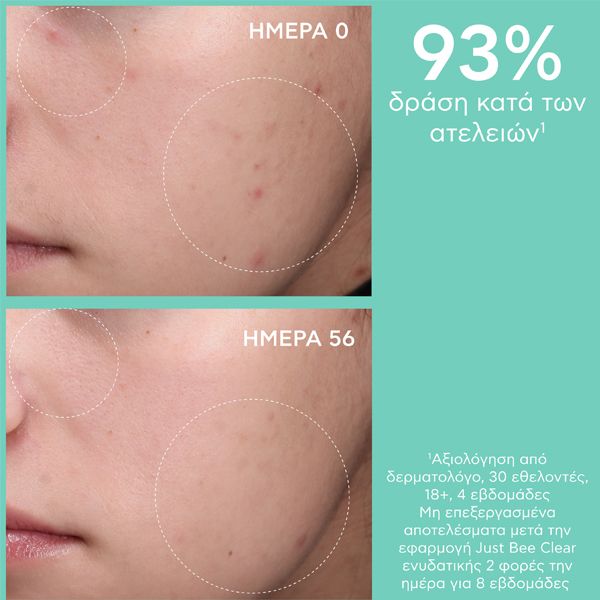 Apivita Just Bee Clear Κρέμα Κατά των Ατελειών για Ενυδάτωση και Ματ Αποτέλεσμα με Propolis AmC και Φυτικό Σαλικυλικό Οξύ 40 ml