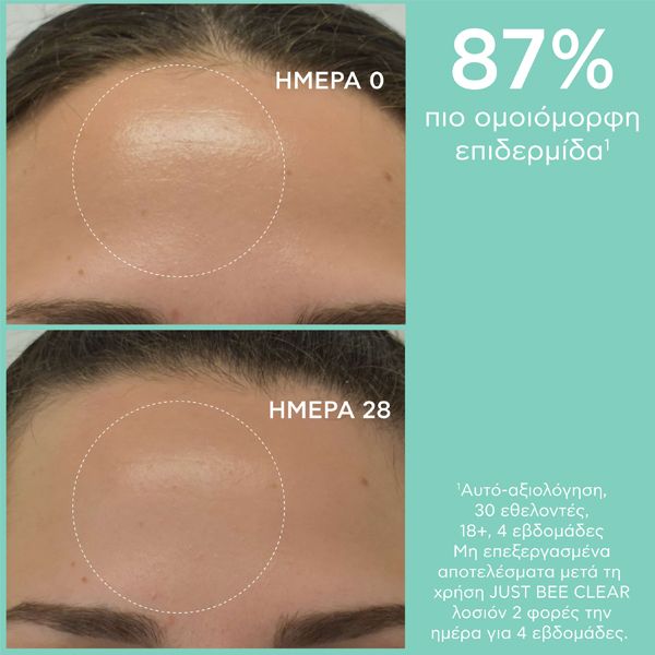 Apivita Just Bee Clear Λοσιόν Σύσφιγξης Πόρων 200 ml
