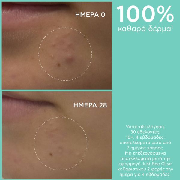 Apivita Just Bee Clear Τζελ Καθαρισμού Εξυγίανσης για Λιπαρό Δέρμα με Τάση Ακμής με Propolis AmC και Φυτικό Σαλικυλικό Οξύ 200 ml