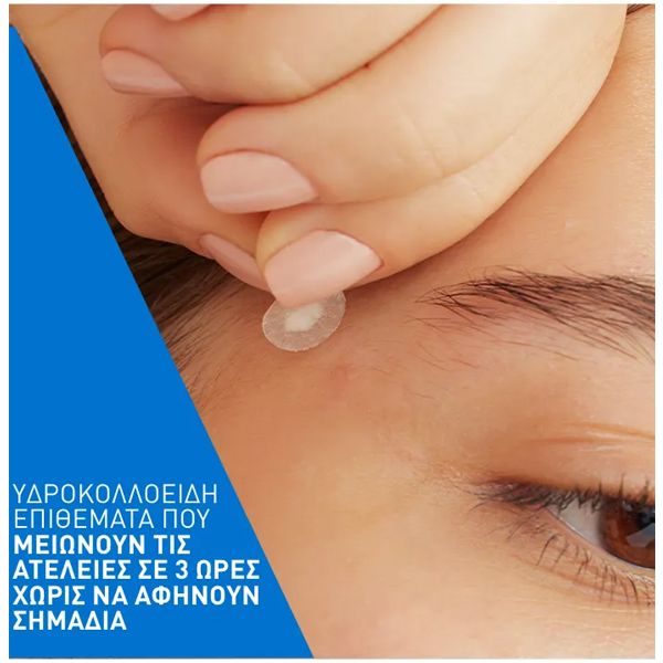 CeraVe Blemish Barrier Patches Επιθέματα Ακμής για Ατέλειες Προσώπου 22 τμχ