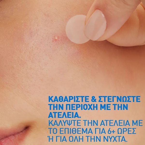 CeraVe Blemish Barrier Patches Επιθέματα Ακμής για Ατέλειες Προσώπου 22 τμχ