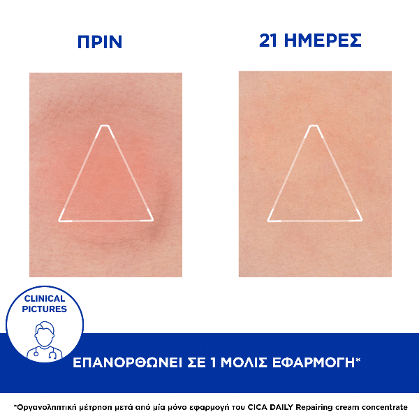 Uriage Cica Daily Serum Ορός για Ευαισθητοποιημένη Επιδερμίδα 30 ml